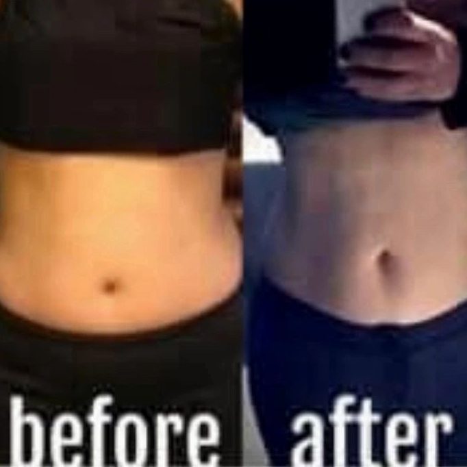 A woman 's before and after picture of her belly button.